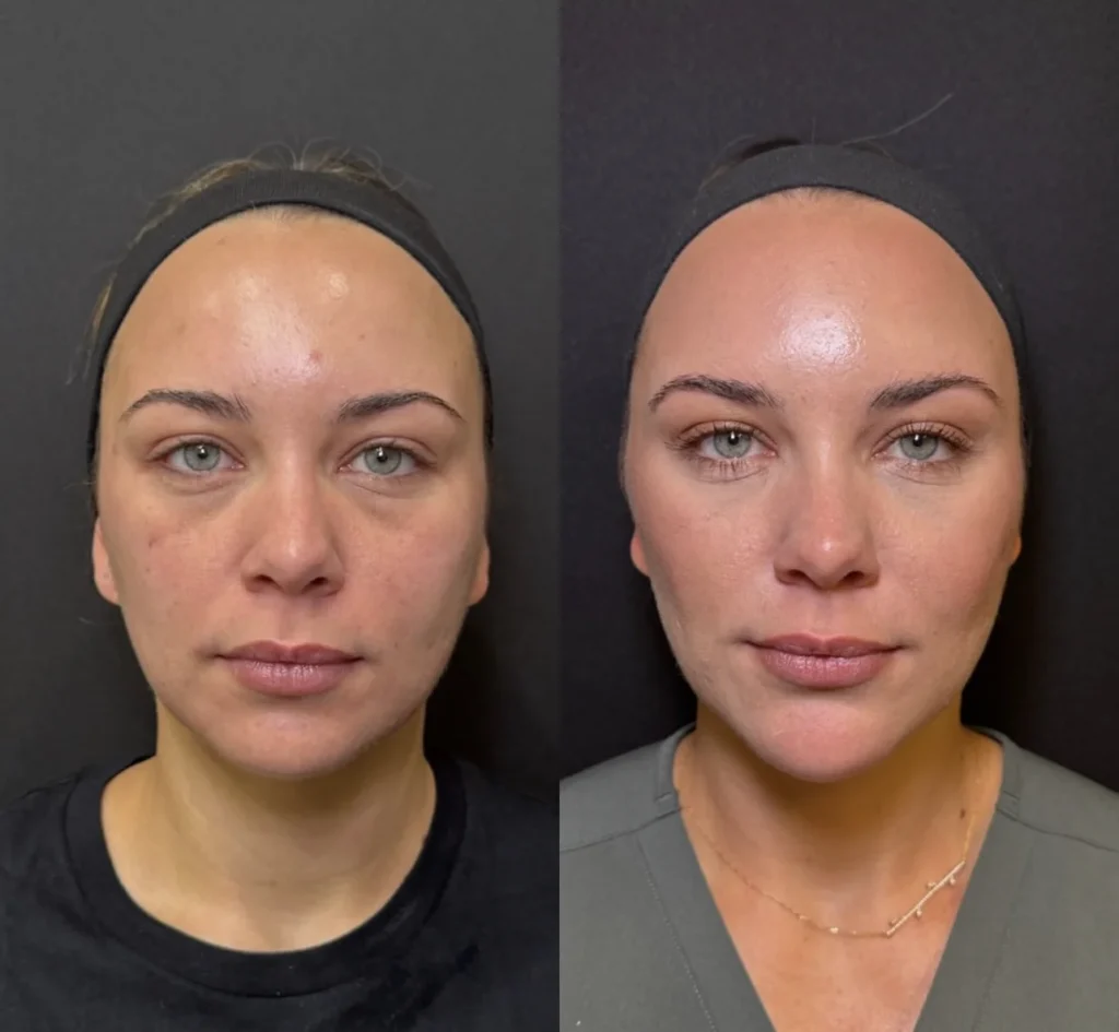 Lavieen - Full Face Harmonização Corporal Estética São Paulo Jardim Paulista